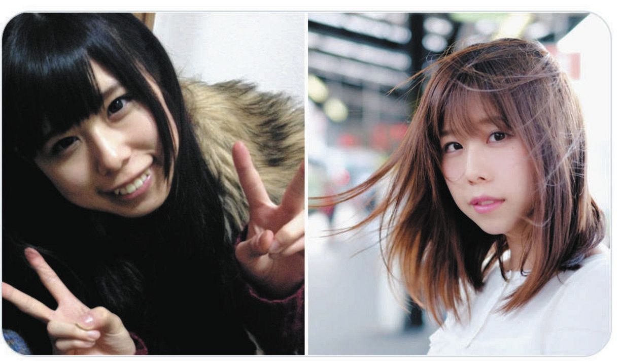 有村藍里の整形前と現在を比較！手術理由と輪郭変化の全真相に迫る