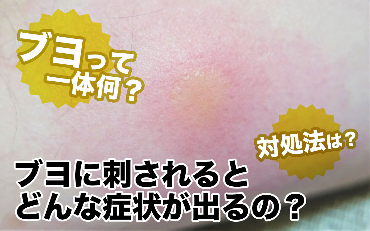 ブヨ刺されの激しい腫れと痒みを最速で治す！正しい応急処置と市販薬