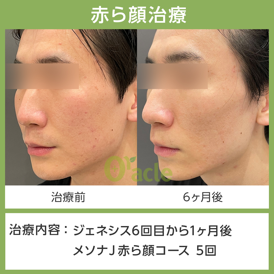 ジェネシスとは？本来の意味から話題の美容医療まで徹底解説