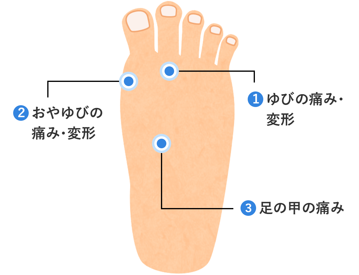 足の甲が歩くと痛い原因とは？疲労骨折のサインと治し方を徹底解説