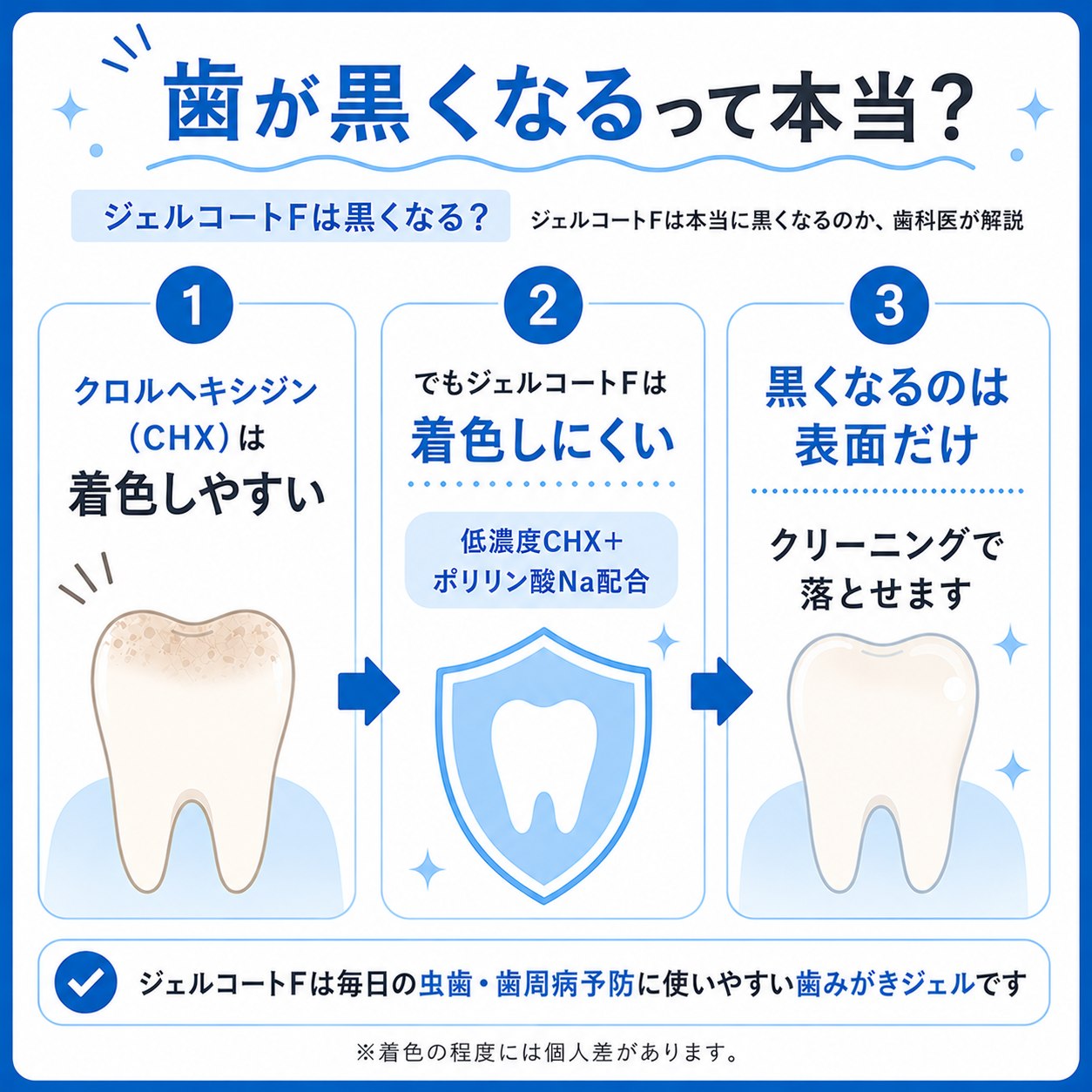 ジェルコートFで歯が黒くなる？黒ずみの原因と白さを保つ対策を徹底解説