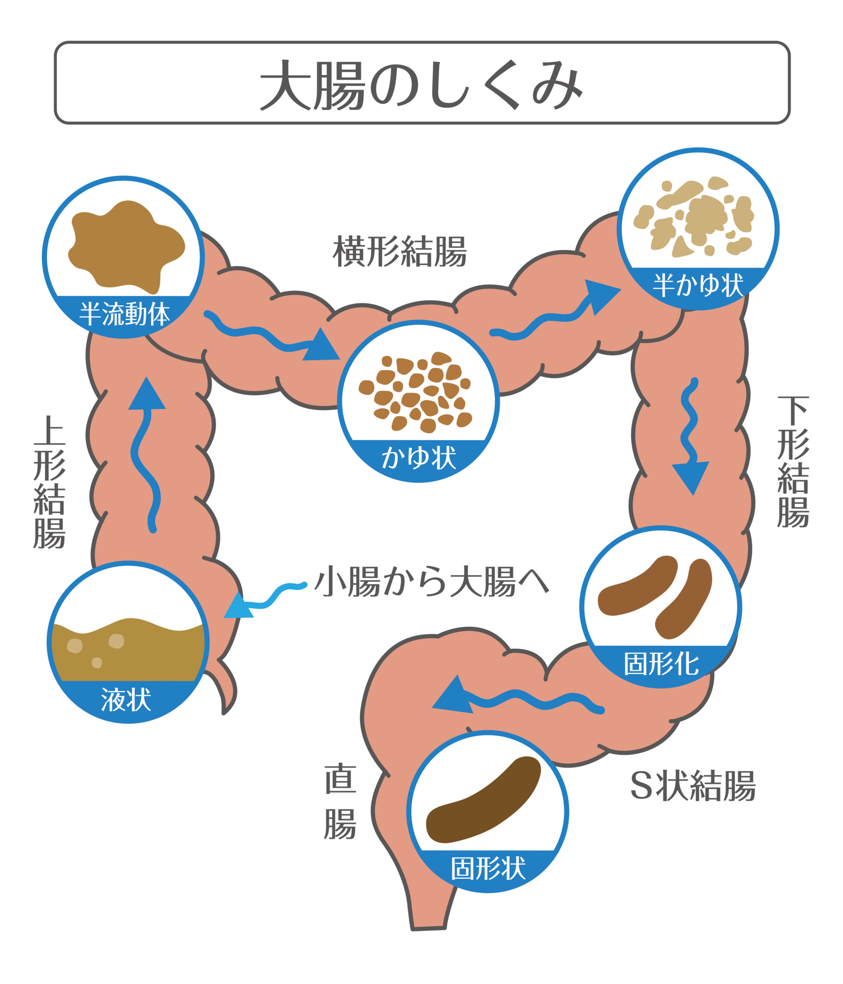 便秘を放置すると命に関わる？危険な症状と病院に行くべき目安を徹底解説