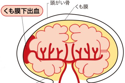 【真相】 星野 源 くも膜 下 出血 2026年最新芸能速報 #855