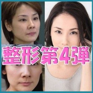 【動画まとめ】 目頭 切開 やりすぎ 芸能人 最新情報まとめ 2026 #897