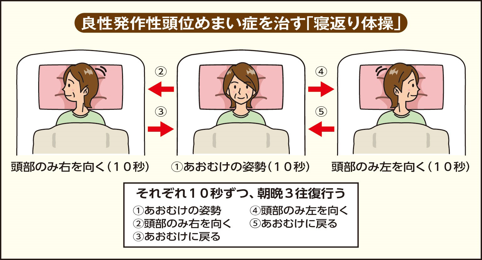 良性発作性頭位めまい症の原因にストレスは本当に関係するのか？決定的理由と2026年最新の対処法