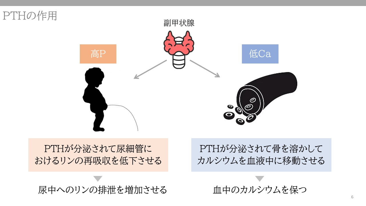 二次性副甲状腺機能亢進症の真実｜初期症状と透析リスク徹底解明