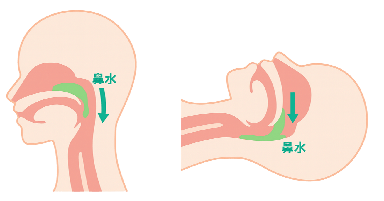 牛乳が鼻から噴き出す理由とは？鼻と口が繋がる構造と逆流の真実