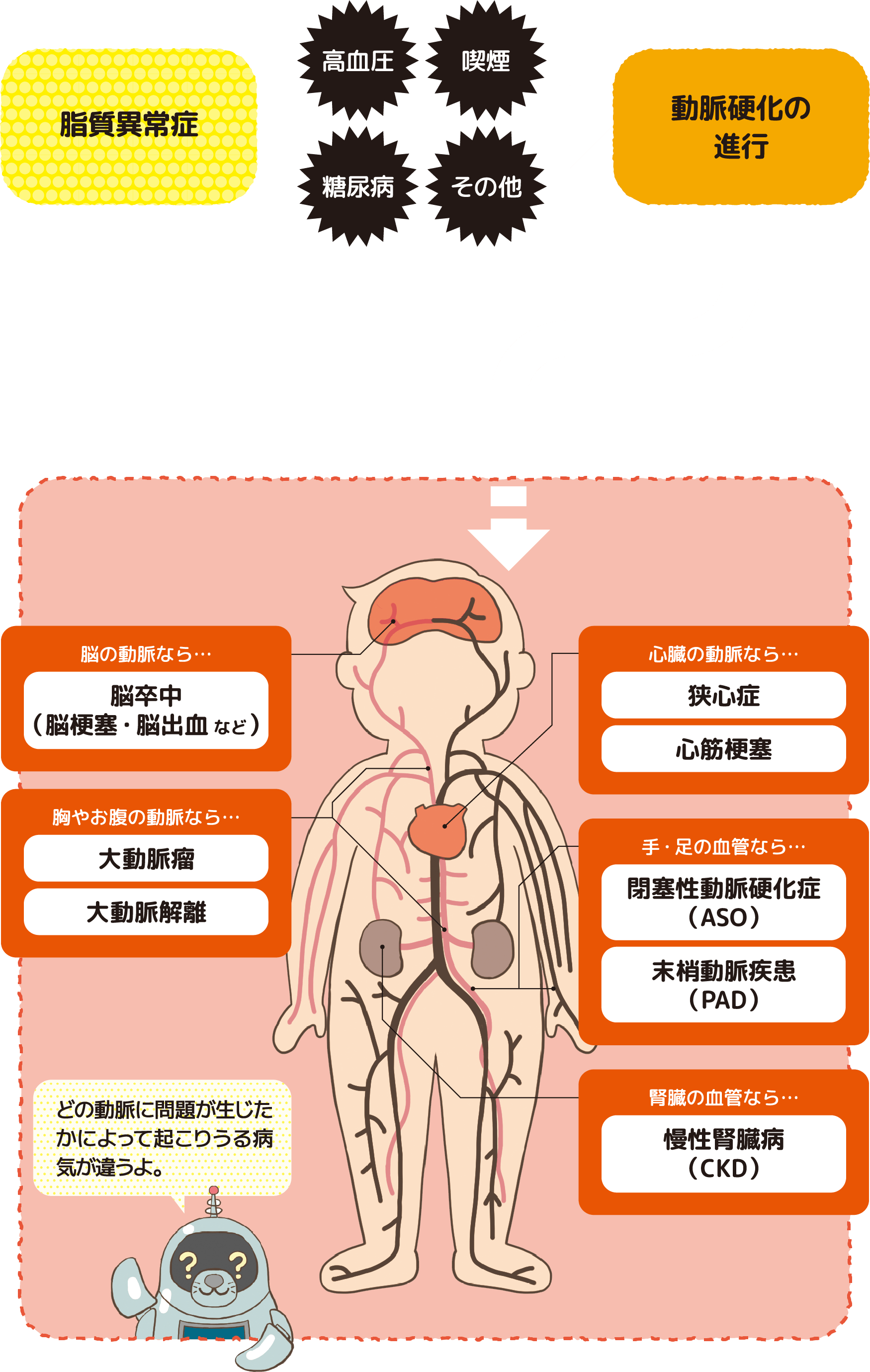 動脈硬化の原因｜加齢だけじゃない血管を蝕む決定的要因と今日からできる改善策