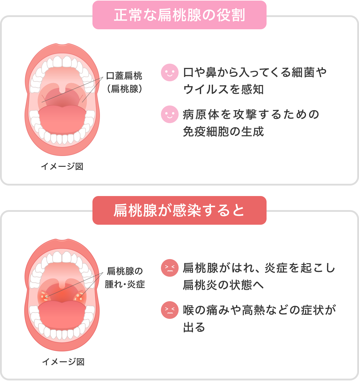 喉の炎症が長引くのはなぜ？2026年最新の原因・症状別の治し方と放置リスクを徹底解説