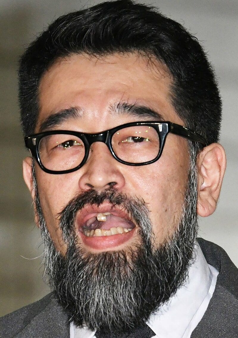 槇原敬之の歯はなぜボロボロだったのか？治さない理由と現在の治療真相