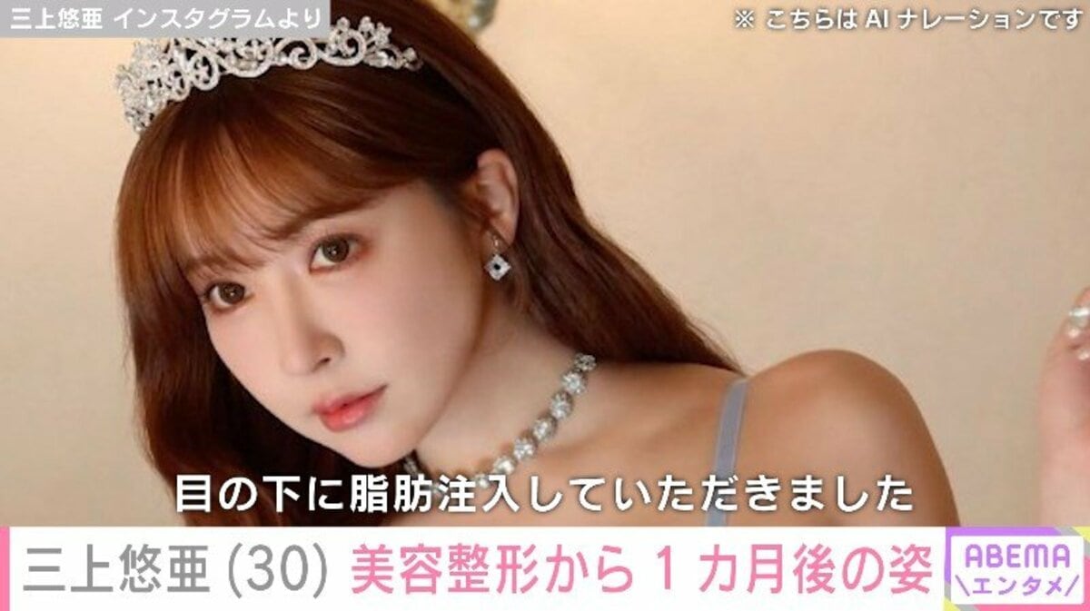 三上悠亜の整形疑惑を徹底検証！Ske時代と現在の顔変化の真実