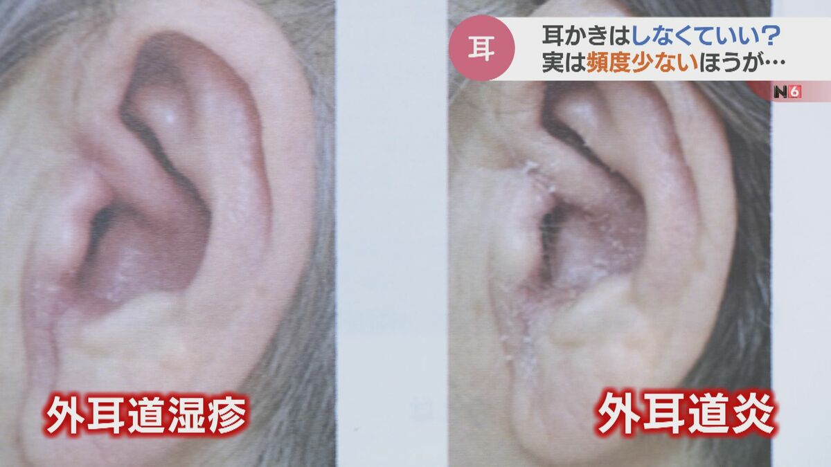耳かきは一切しない方がいい？耳鼻科医が教える噂の真相と正しいケア