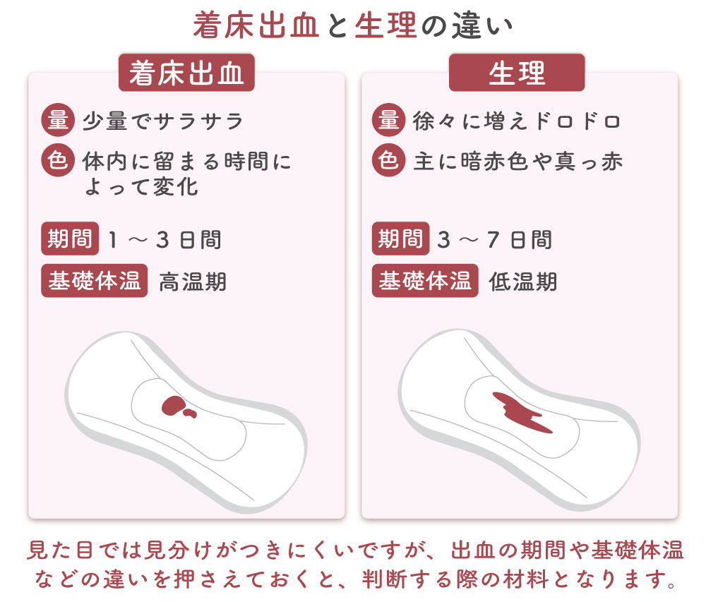 着床出血とは？生理との違い・時期・色・確率を徹底解説【2026最新】