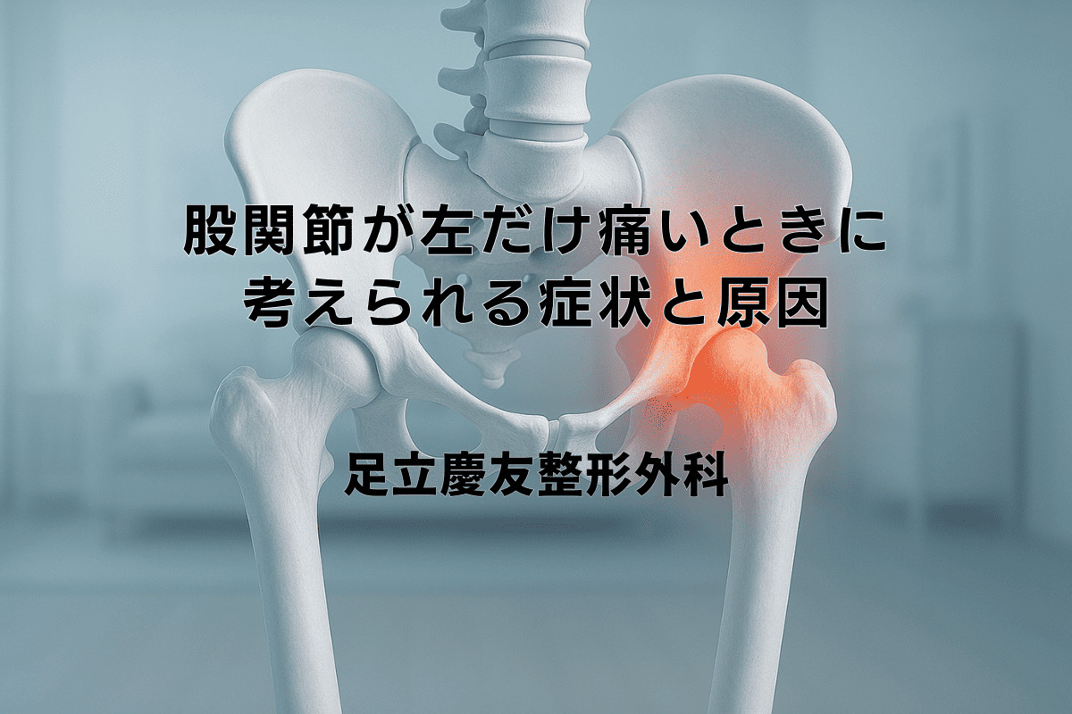 股関節の左だけ痛い原因とは？歩行時の違和感や危険な病気を徹底解説