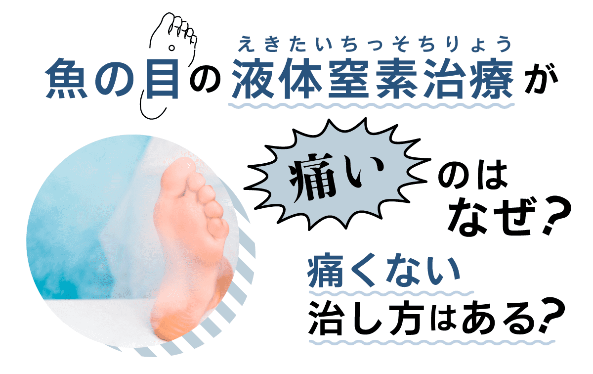イボの液体窒素治療が激痛な理由とは？痛みのピークと対処法まとめ