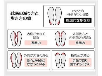 靴の減り方でわかる寿命？「外側重心」が引き起こす関節崩壊を防ぐ最新アプローチ