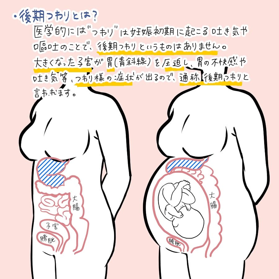 妊娠後期の吐き気なぜぶり返す？原因と胃もたれ解消法を徹底解説