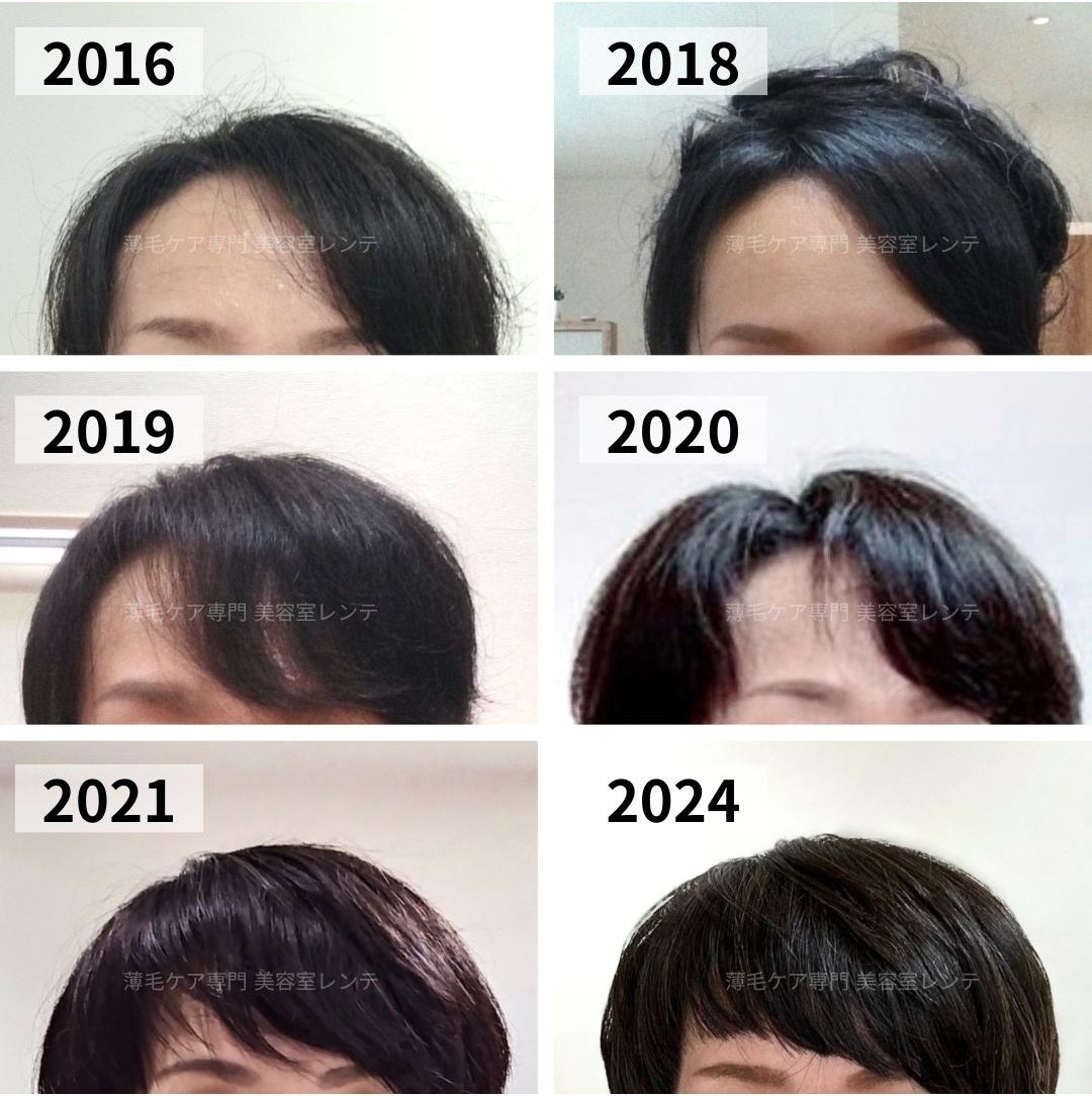 頭皮マッサージを続けた女性の真実！髪と顔の劇的変化と失敗防止策