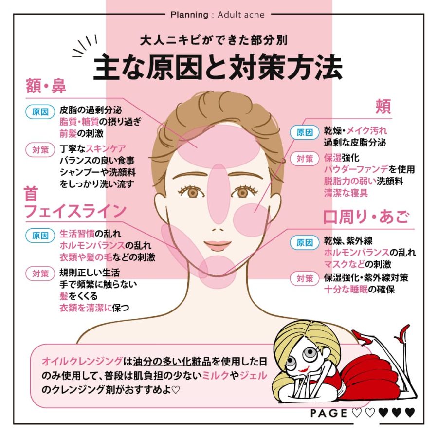 何度も繰り返す顎周りニキビの原因とは？治らない決定打と最新改善策