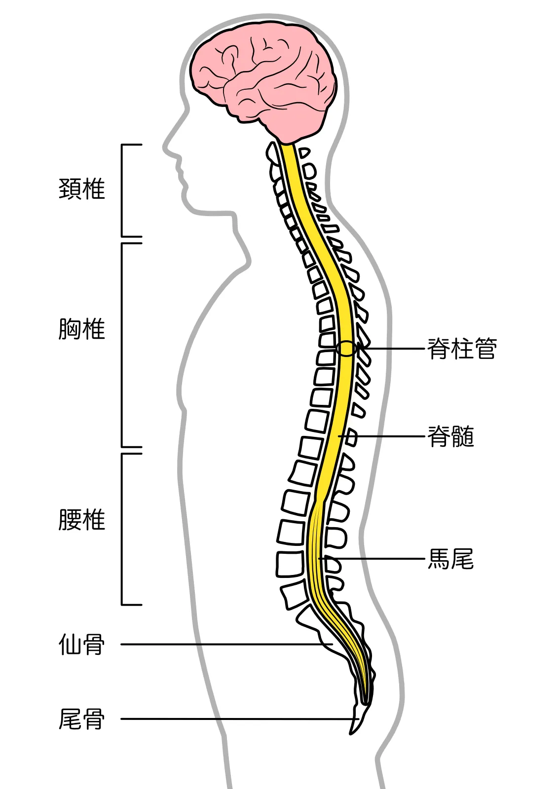 脊髄梗塞の症状と初期サインとは？激痛から回復までの全貌と最新治療