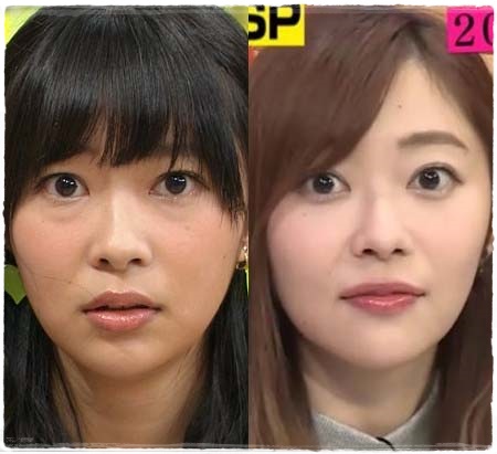 【速報】 白玉 点滴 芸能人 人気理由と評判まとめ #662
