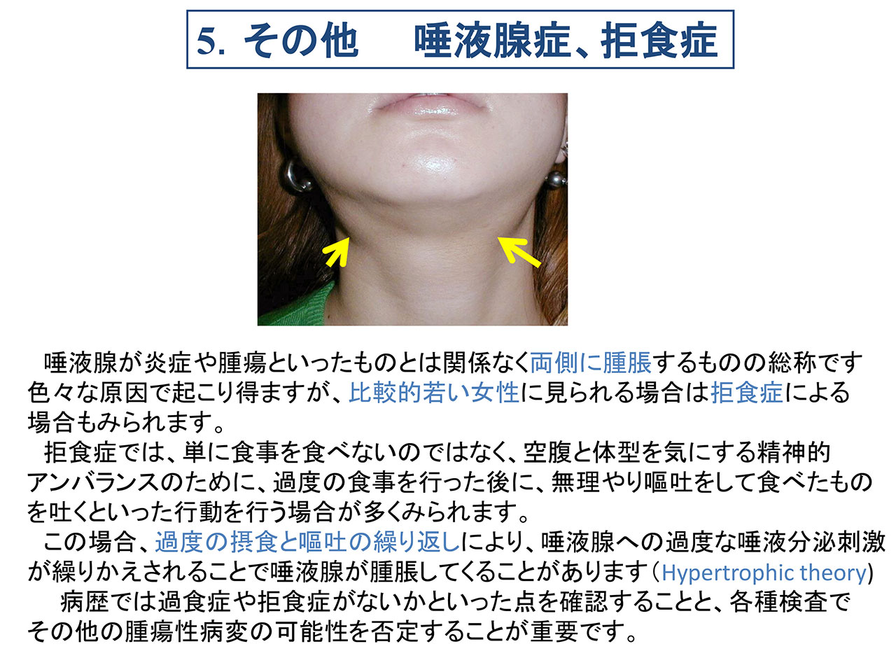 顎下腺がんを疑うべき初期症状と2026年最新生存率データ｜放置できない“あごの下の違和感”の正体