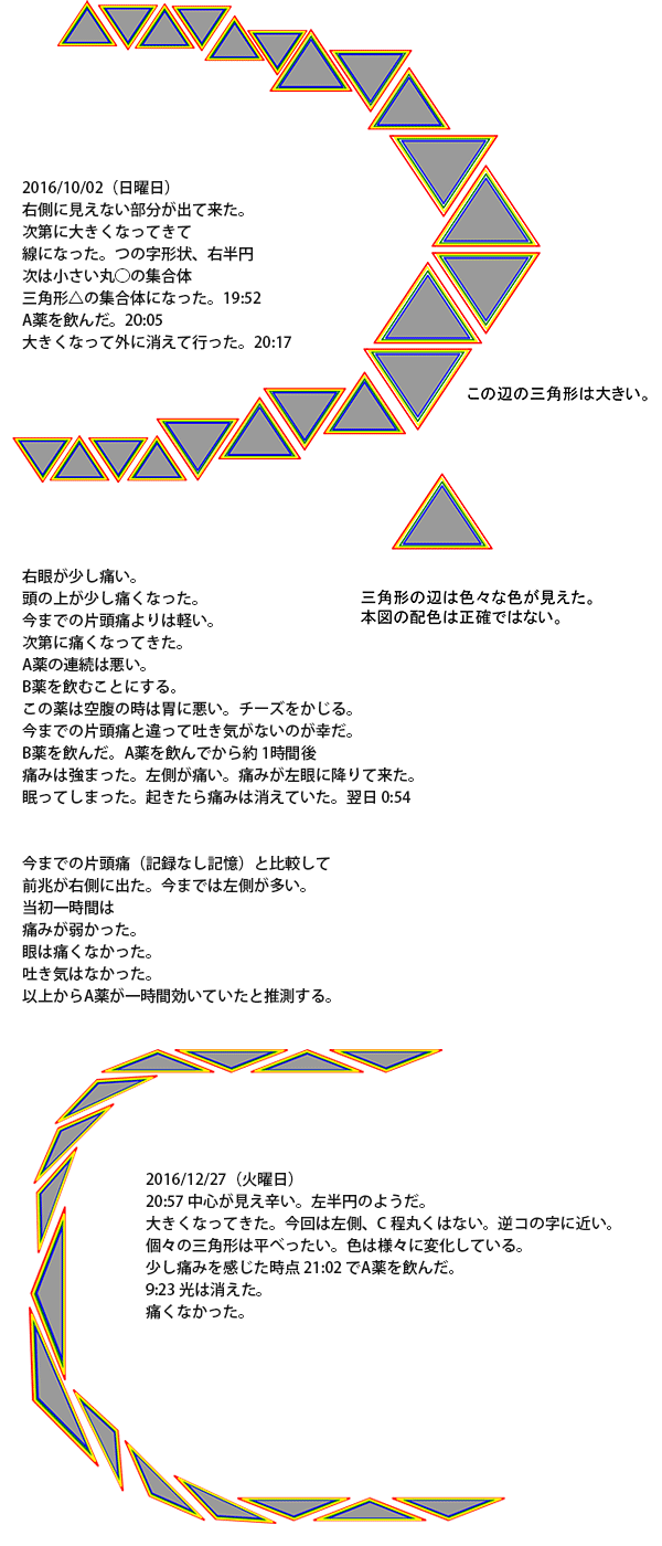 閃輝暗点の原因と潜む重大リスク｜頭痛なしは脳梗塞の前兆か検証