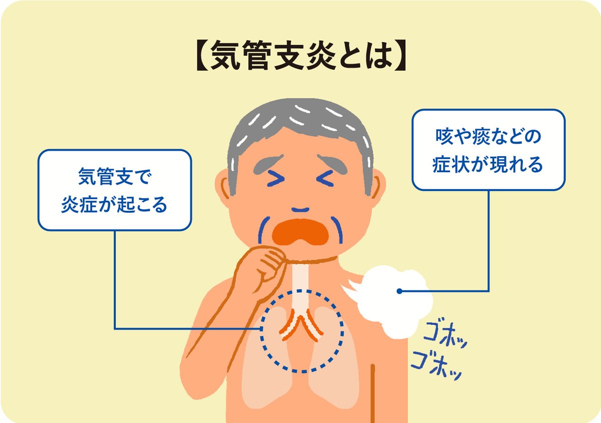 気管支炎は何科を受診？一般内科と呼吸器内科の違いや受診目安を解説