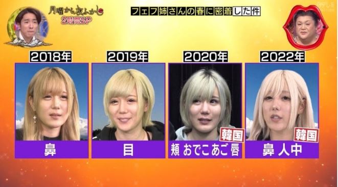 【2026最新】 多田 さん 整形 前 インスタライブ最新動画 #637