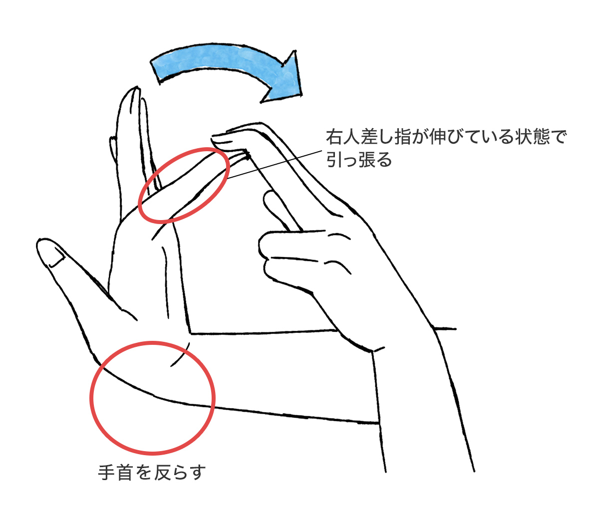 腱鞘炎の治し方を間違えると悪化するケースも。放置リスクと今すぐできる対処法