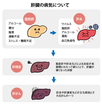 【噂】 肝臓 に 悪い もの 私服＆私生活最新ショット #924