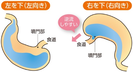 尿量が多い原因と危険な病気のサイン｜多尿症の診断基準と受診目安